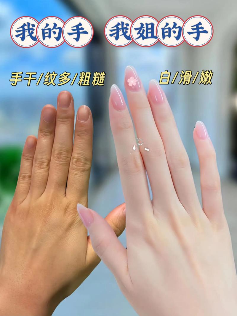 手部护理
